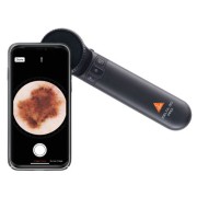 Dermatoscopes