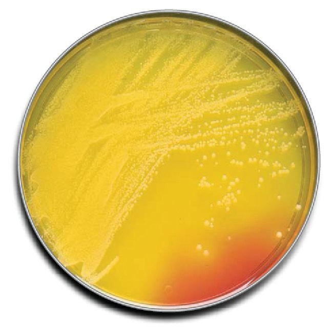 TSA +P80+LRodac-contact Agar - 100 pcs.