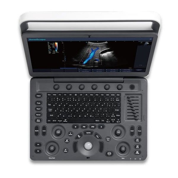 SonoScape E3 ultrasound device SonoScape E3 ultrasound device