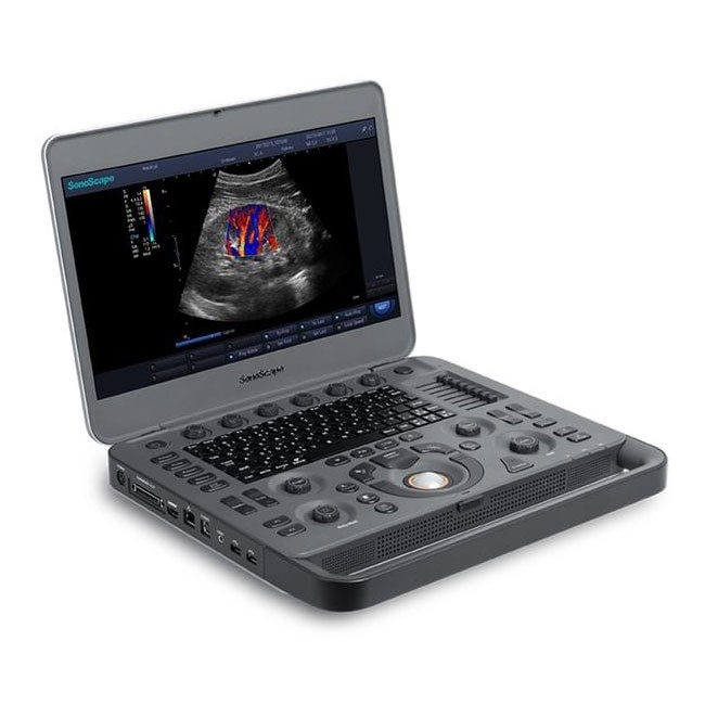 SonoScape X3 ultrasound device SonoScape X3 ultrasound device