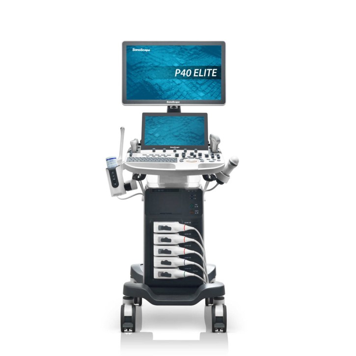 SonoScape P40 elite ultrasound device SonoScape P40 elite ultrasound device