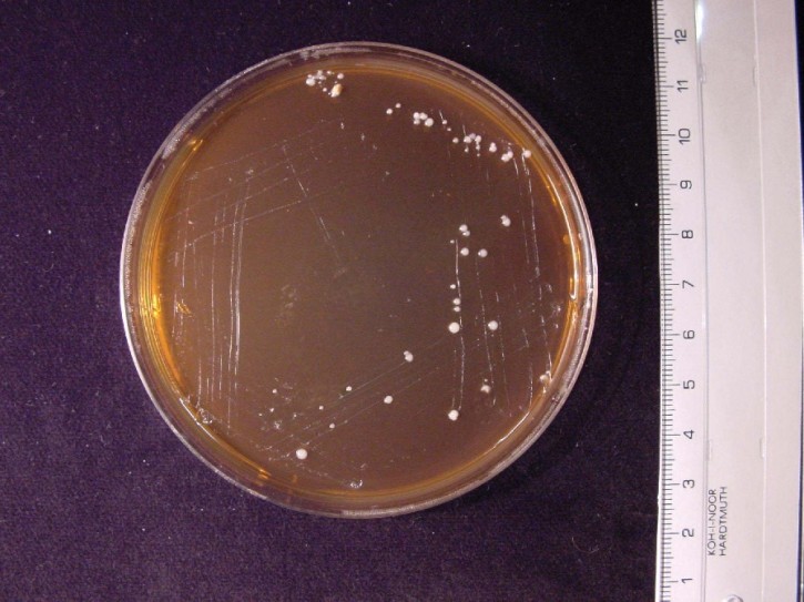 Bifidobacterium Agar (20 Pl.)