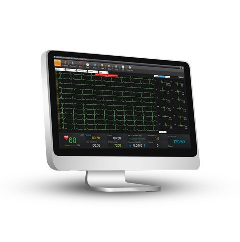 SE-1515 PC-EKG, kabelgebunden mit GDT-Schnittstelle