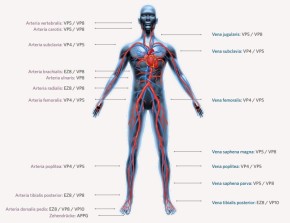 Huntleigh Gefäßdoppler SD2 ohne Sonde Bi-direktionaler Gefäßdoppler