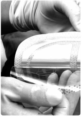 Erbe NESSY® Omega Plate (85+23)cm², without cable