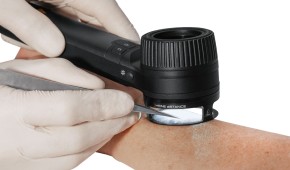 HEINE diSTANCE Arbeitsring für DELTA 30, DELTA 30 PRO Dermatoskop