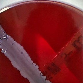 Columbia Sheep Blood Agar ready - 20 pcs.
